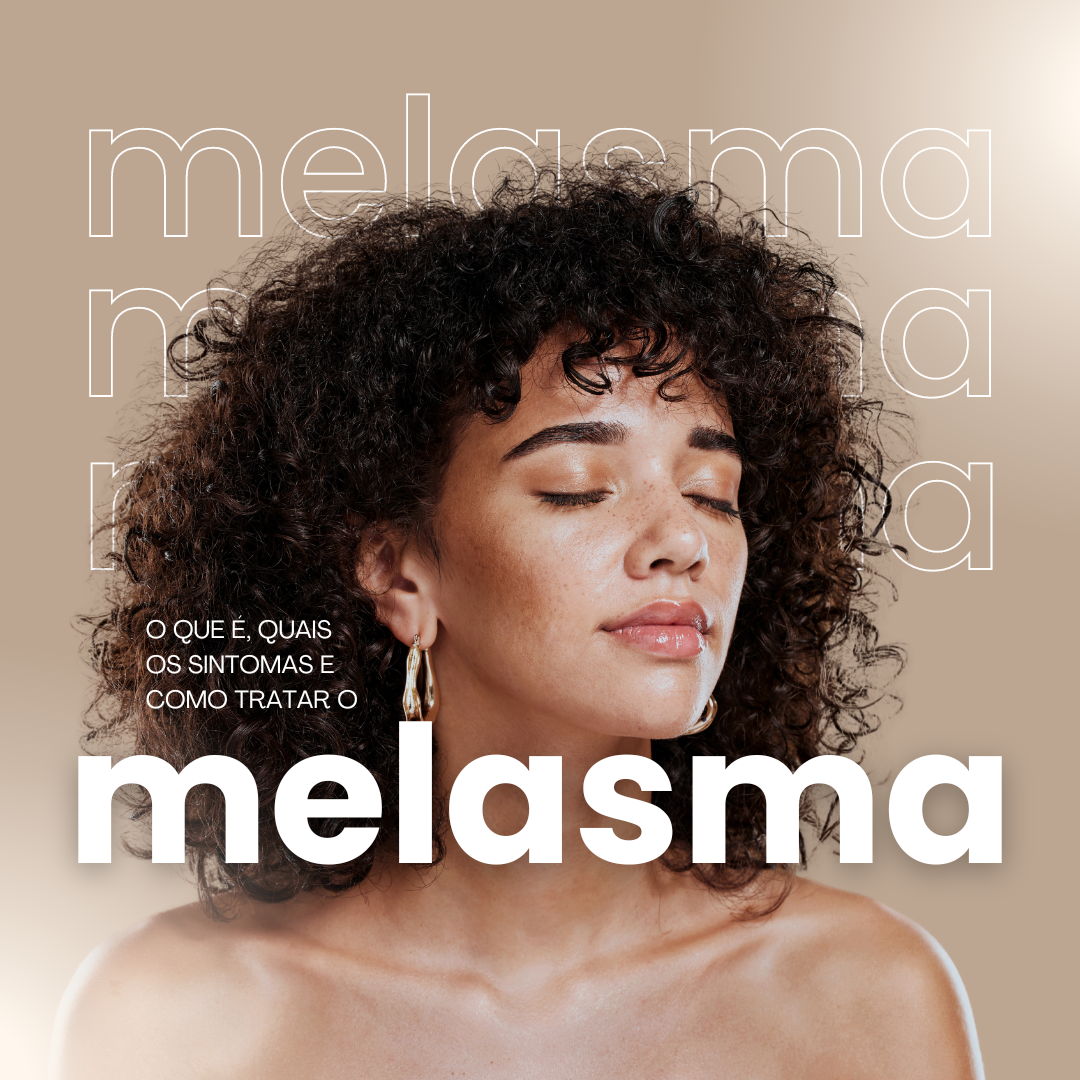 O que é Melasma e Quais São Seus Principais Sintomas?